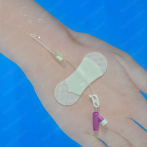 A2 Indwelling Needle Fixation Patch