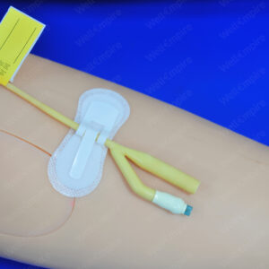 C2 PEDIATRIC Catheter and Drainage Tube Fxation