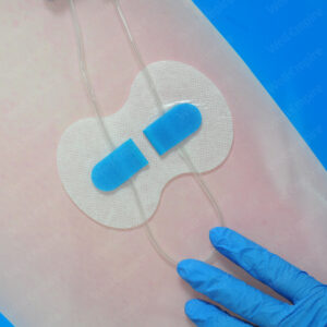 A7 Indwelling Needle, Central venous Catheter Fixation Patch