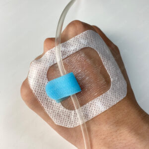 A4-1 Indwelling Needle, Peripheral IV Enhanced Acrylic Glue Catheter Fixation Patch